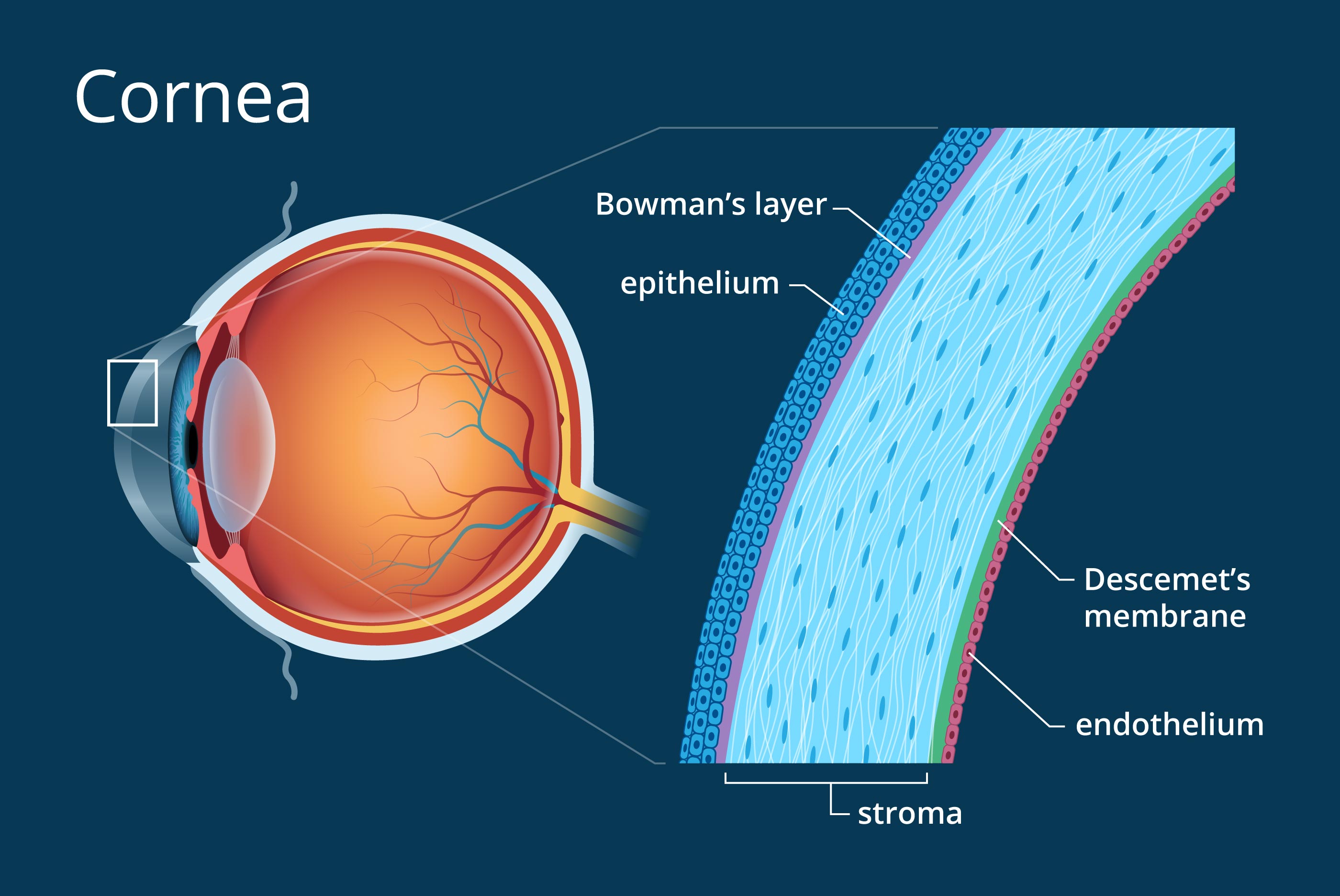 Cornea anatomy showing the layers affected by scarring